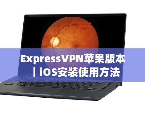 ExpressVPN苹果版本｜iOS安装使用方法